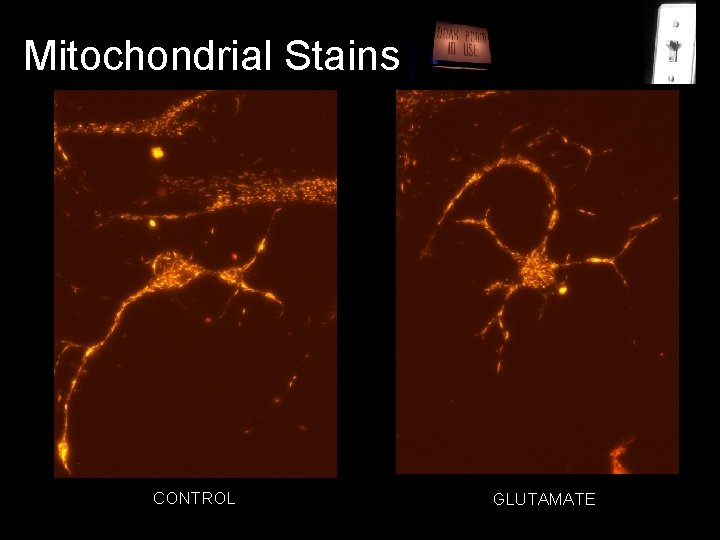 Mitochondrial Stains CONTROL GLUTAMATE 
