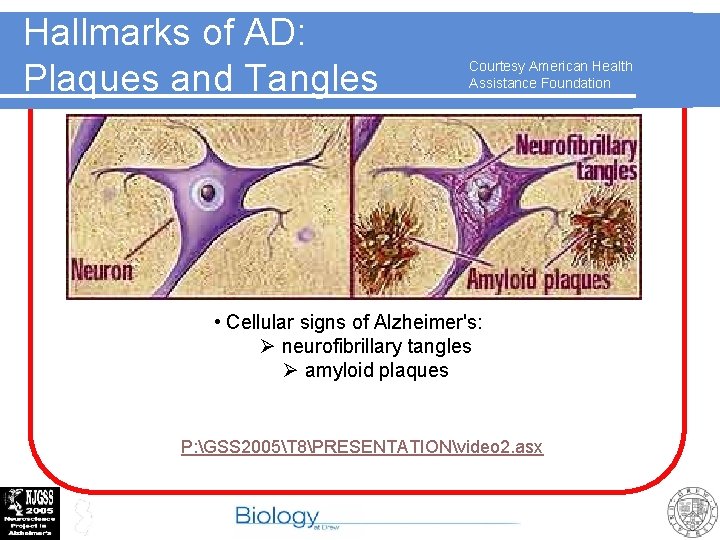 Hallmarks of AD: Plaques and Tangles Courtesy American Health Assistance Foundation • Cellular signs