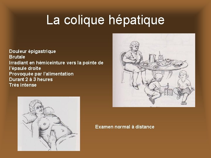 La colique hépatique Douleur épigastrique Brutale Irradiant en hémiceinture vers la pointe de l’épaule