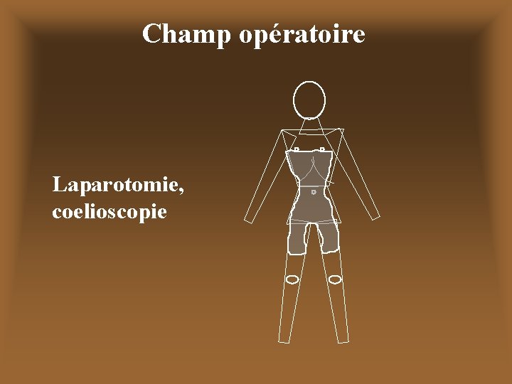 Champ opératoire Laparotomie, coelioscopie 