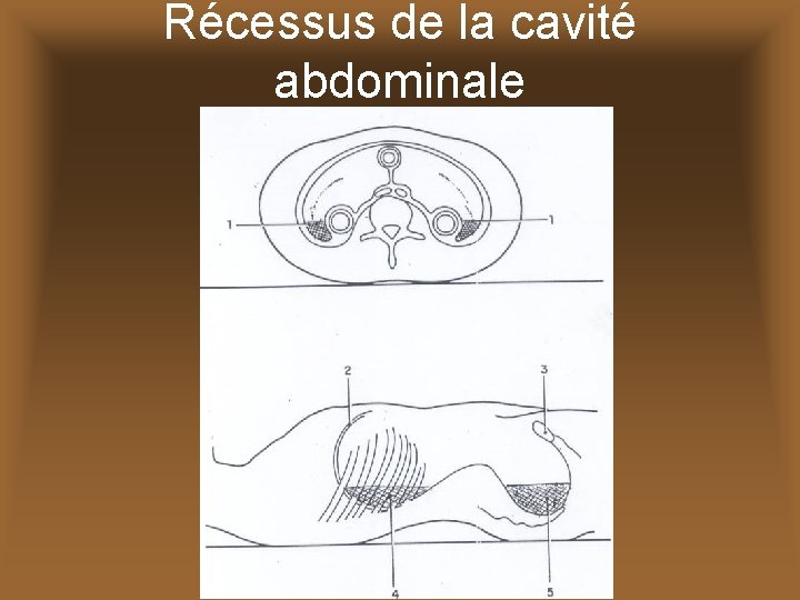 Récessus de la cavité abdominale 