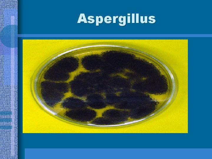 Aspergillus 