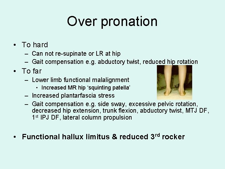 Over pronation • To hard – Can not re-supinate or LR at hip –