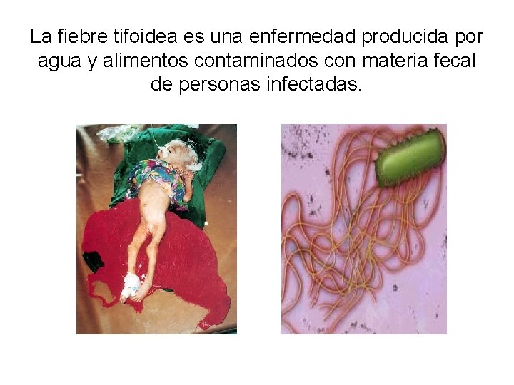 La fiebre tifoidea es una enfermedad producida por agua y alimentos contaminados con materia