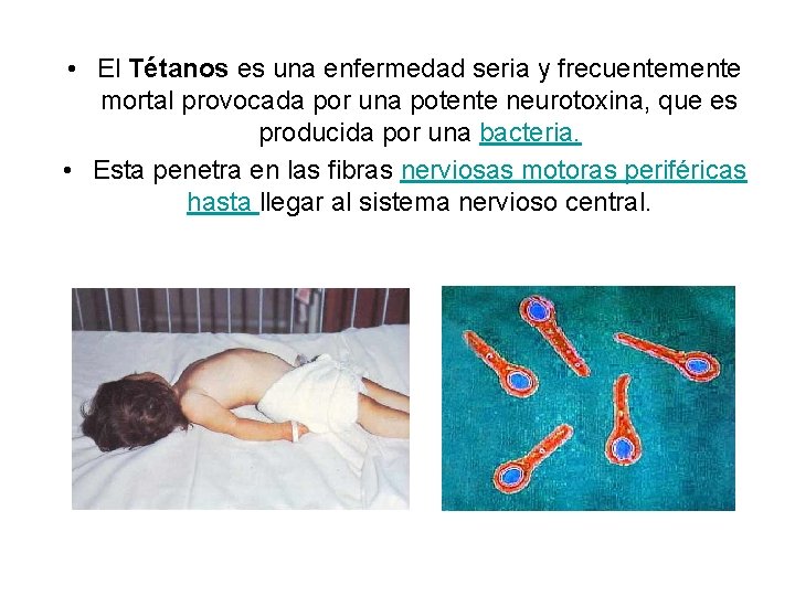  • El Tétanos es una enfermedad seria y frecuentemente mortal provocada por una