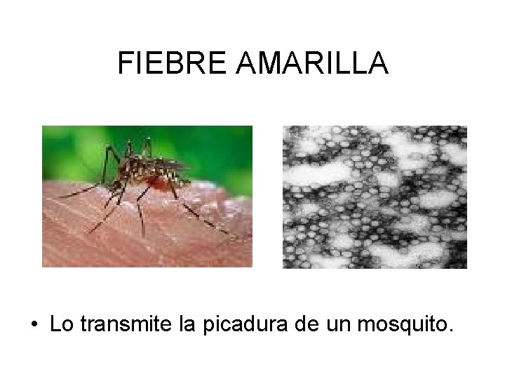 FIEBRE AMARILLA • Lo transmite la picadura de un mosquito. 