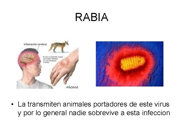 RABIA • La transmiten animales portadores de este virus y por lo general nadie