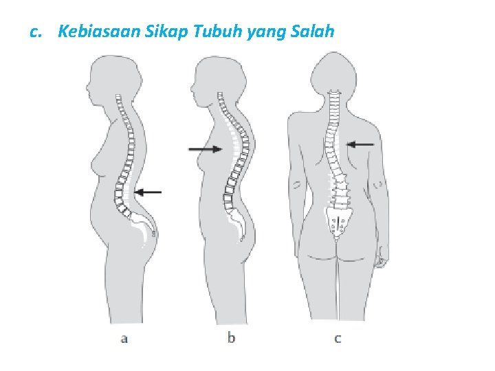 c. Kebiasaan Sikap Tubuh yang Salah 