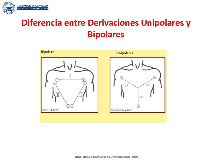 Diferencia entre Derivaciones Unipolares y Bipolares www. drleonardomoya. wordpress. com 