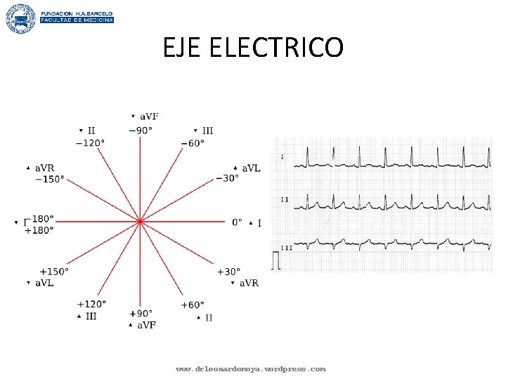 EJE ELECTRICO www. drleonardomoya. wordpress. com 