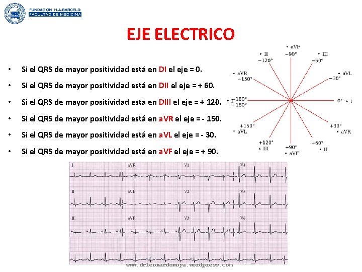 EJE ELECTRICO • Si el QRS de mayor positividad está en DI el eje