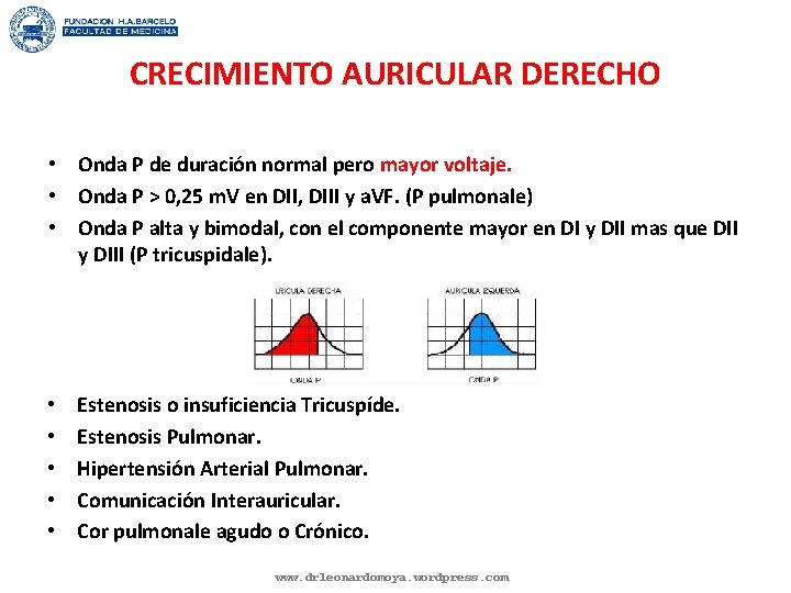 CRECIMIENTO AURICULAR DERECHO • Onda P de duración normal pero mayor voltaje. • Onda