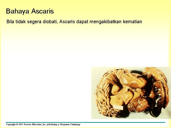 Bahaya Ascaris Bila tidak segera diobati, Ascaris dapat mengakibatkan kematian Copyright © 2005 Pearson