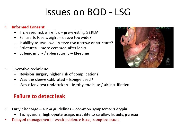 Issues on BOD - LSG • Informed Consent – Increased risk of reflux –