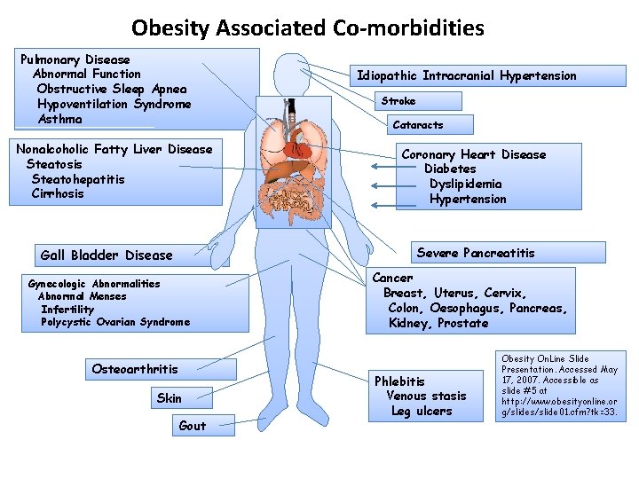 Obesity Associated Co-morbidities Pulmonary Disease Abnormal Function Obstructive Sleep Apnea Hypoventilation Syndrome Asthma Nonalcoholic