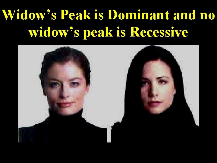 Widow’s Peak is Dominant and no widow’s peak is Recessive 