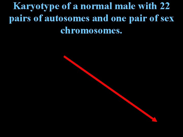 Karyotype of a normal male with 22 pairs of autosomes and one pair of