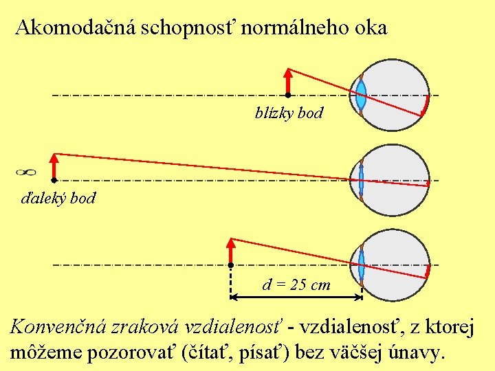 Akomodačná schopnosť normálneho oka blízky bod ďaleký bod d = 25 cm Konvenčná zraková
