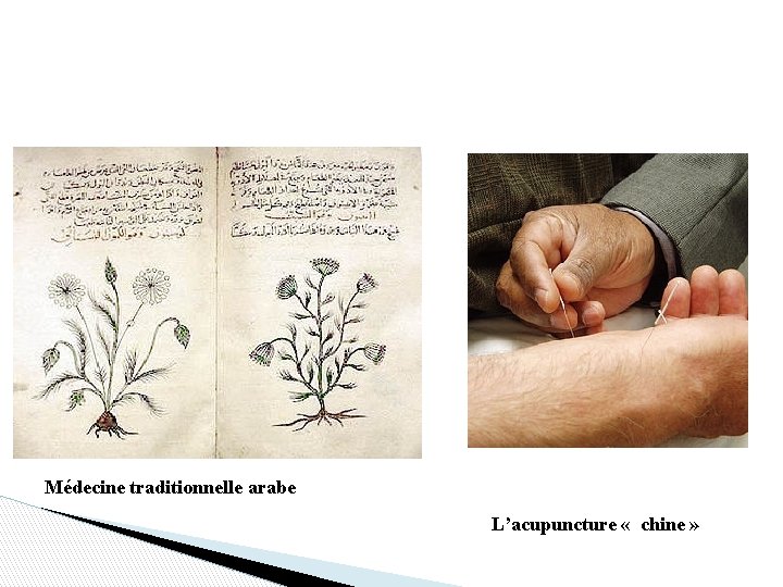 Médecine traditionnelle arabe L’acupuncture « chine » 