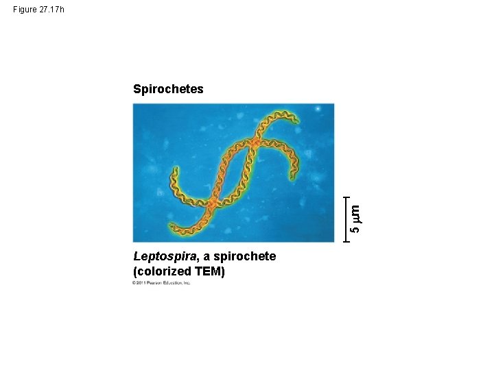 Figure 27. 17 h 5 m Spirochetes Leptospira, a spirochete (colorized TEM) 