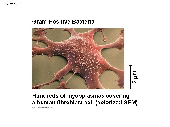 Figure 27. 17 k 2 m Gram-Positive Bacteria Hundreds of mycoplasmas covering a human