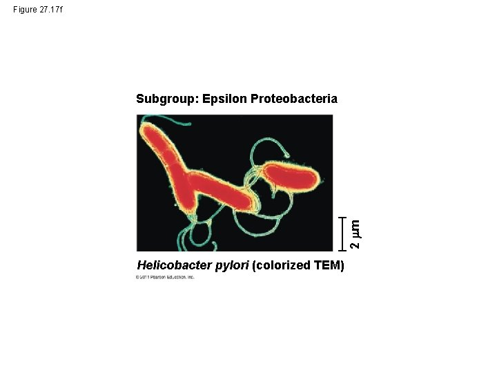 Figure 27. 17 f 2 m Subgroup: Epsilon Proteobacteria Helicobacter pylori (colorized TEM) 
