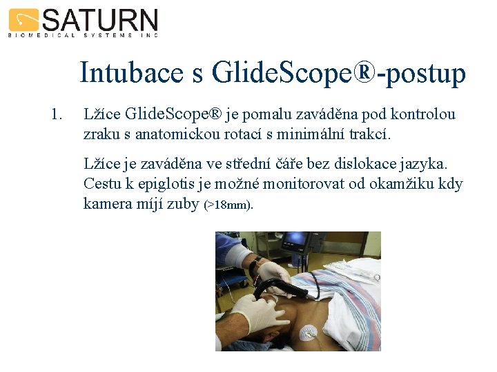 Intubace s Glide. Scope®-postup 1. Lžíce Glide. Scope® je pomalu zaváděna pod kontrolou zraku