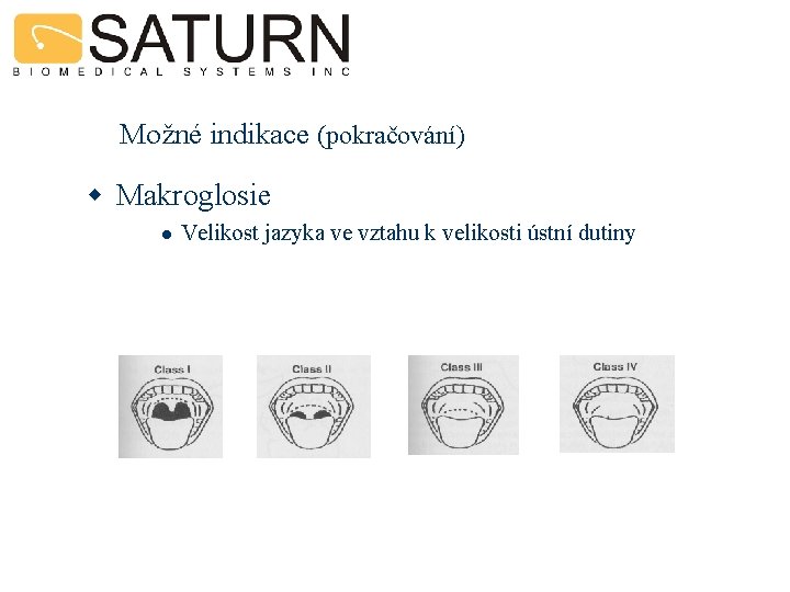 Možné indikace (pokračování) w Makroglosie l Velikost jazyka ve vztahu k velikosti ústní dutiny
