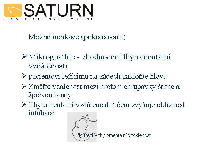 Možné indikace (pokračování) Ø Mikrognathie - zhodnocení thyromentální vzdálenosti Ø pacientovi ležícímu na zádech