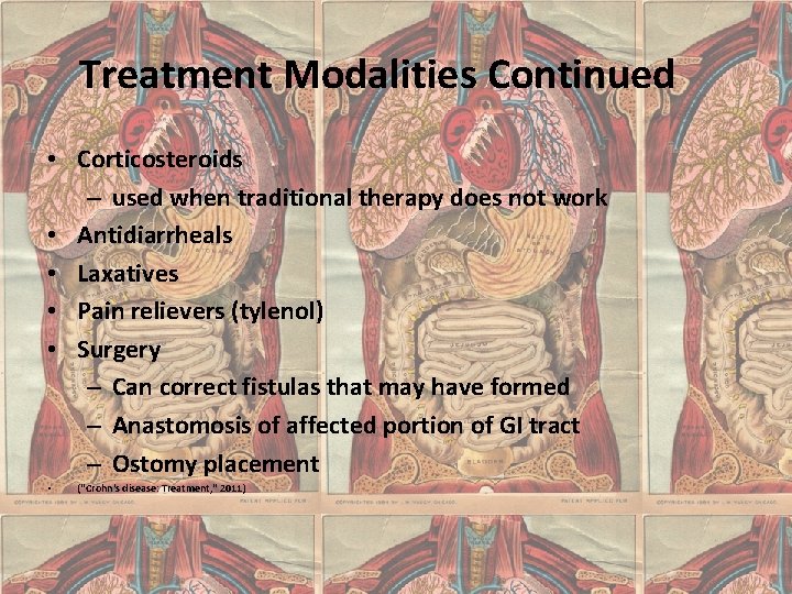 Treatment Modalities Continued • Corticosteroids – used when traditional therapy does not work •
