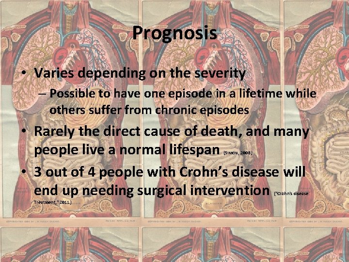 Prognosis • Varies depending on the severity – Possible to have one episode in