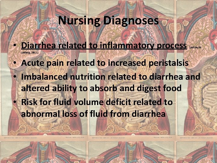 Nursing Diagnoses • Diarrhea related to inflammatory process (Ackley & Ladwig, 2011) • Acute