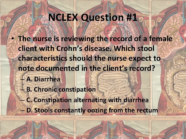 NCLEX Question #1 • The nurse is reviewing the record of a female client