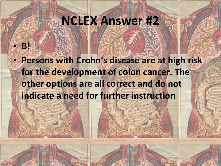 NCLEX Answer #2 • B! • Persons with Crohn’s disease are at high risk