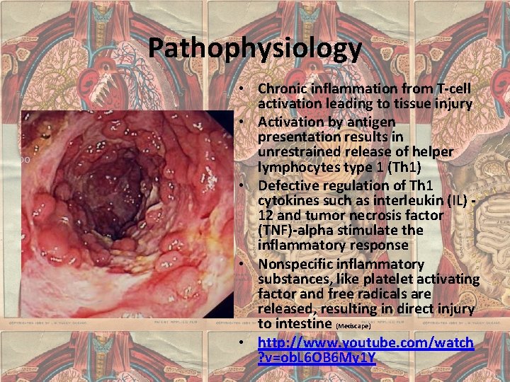 Pathophysiology • Chronic inflammation from T-cell activation leading to tissue injury • Activation by