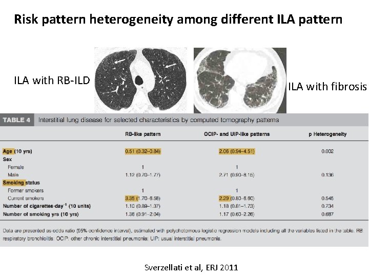 Risk pattern heterogeneity among different ILA pattern ILA with RB-ILD ILA with fibrosis Sverzellati