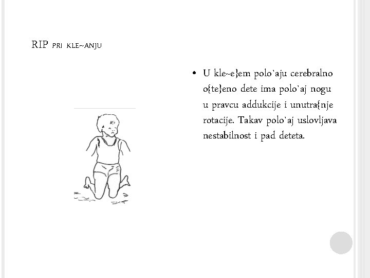 RIP PRI KLE~ANJU • U kle~e}em polo`aju cerebralno o{te}eno dete ima polo`aj nogu u