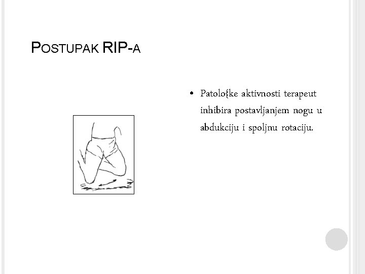 POSTUPAK RIP-A • Patolo{ke aktivnosti terapeut inhibira postavljanjem nogu u abdukciju i spoljnu rotaciju.