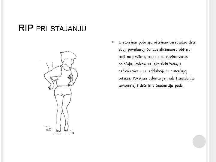 RIP PRI STAJANJU • U stoje}em polo`aju o{te}eno cerebralno dete zbog pove}anog tonusa ekstenzora