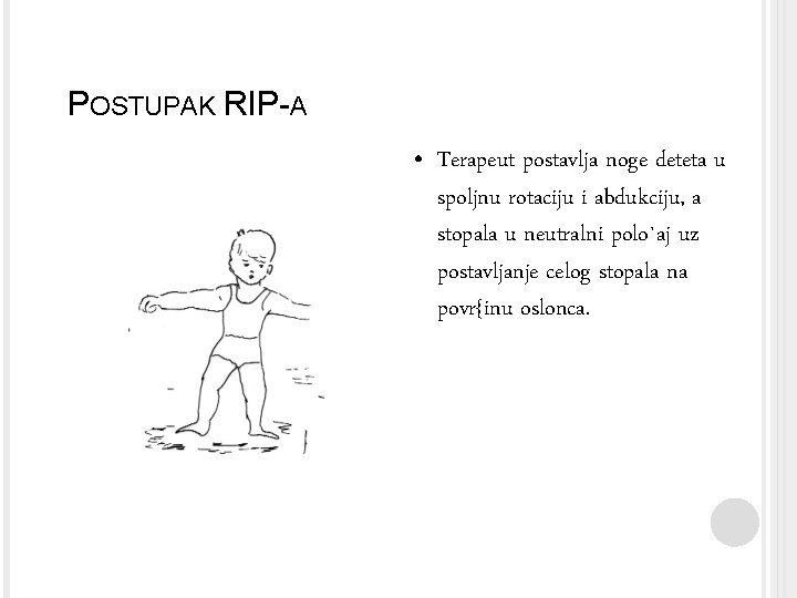 POSTUPAK RIP-A • Terapeut postavlja noge deteta u spoljnu rotaciju i abdukciju, a stopala