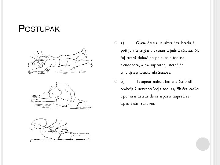 POSTUPAK a) Glava deteta se uhvati za bradu i potilja~nu regiju i okrene u