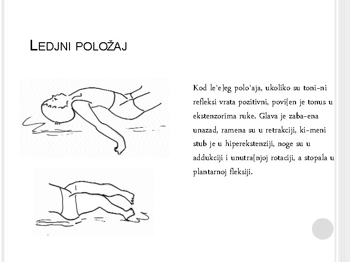 LEDJNI POLOŽAJ Kod le`e}eg polo`aja, ukoliko su toni~ni refleksi vrata pozitivni, povi{en je tonus