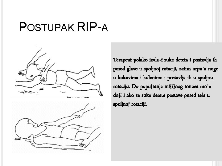 POSTUPAK RIP-A Terapeut polako izvla~i ruke deteta i postavlja ih pored glave u spoljnoj