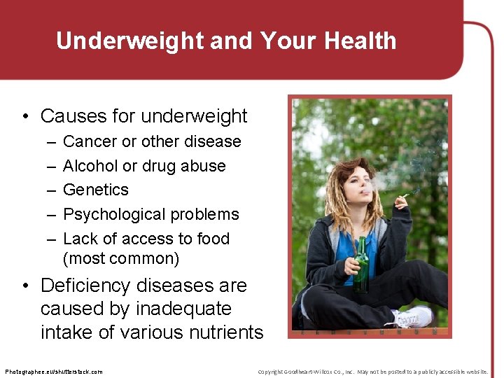 Underweight and Your Health • Causes for underweight – – – Cancer or other