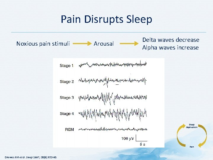 Pain Disrupts Sleep Noxious pain stimuli Arousal Delta waves decrease Alpha waves increase Sleep