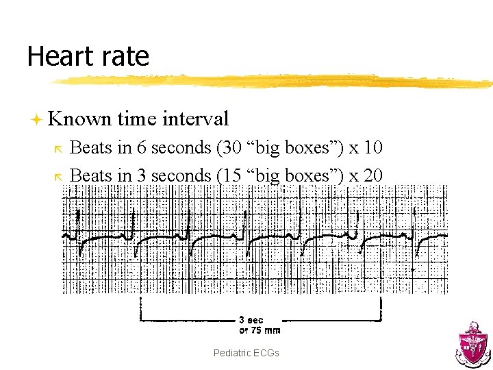 Heart rate ª Known ã ã time interval Beats in 6 seconds (30 “big