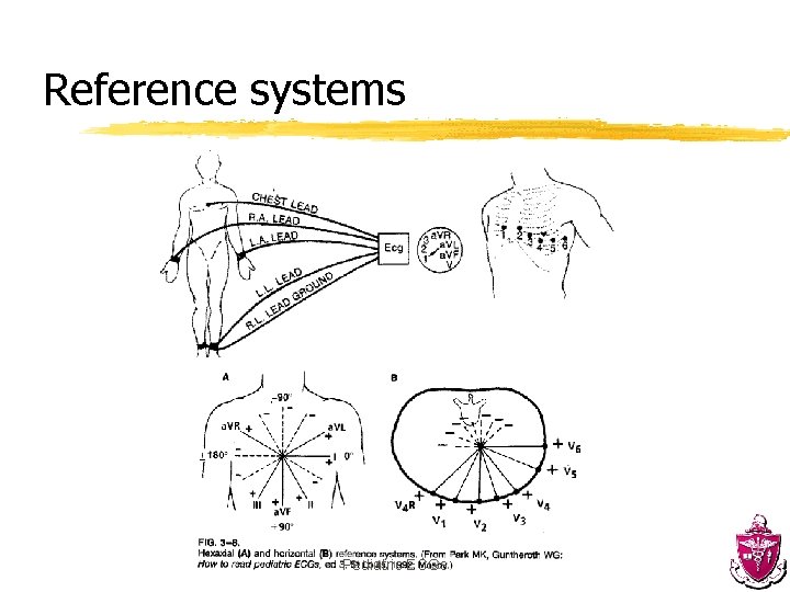 Reference systems Pediatric ECGs 