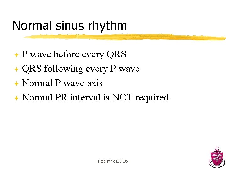 Normal sinus rhythm P wave before every QRS ª QRS following every P wave