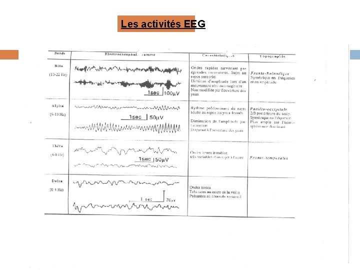Les activités EEG 
