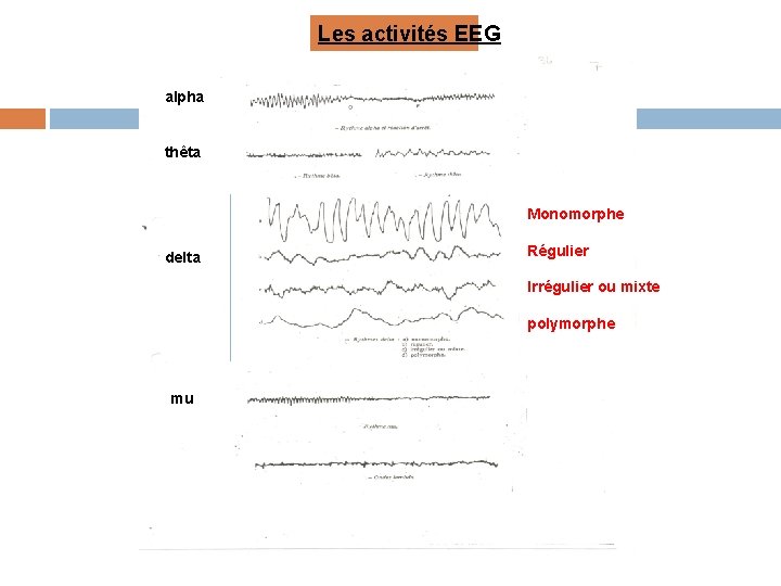 Les activités EEG alpha thêta Monomorphe delta Régulier Irrégulier ou mixte polymorphe mu 